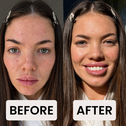 AHA Peeling Concentrate