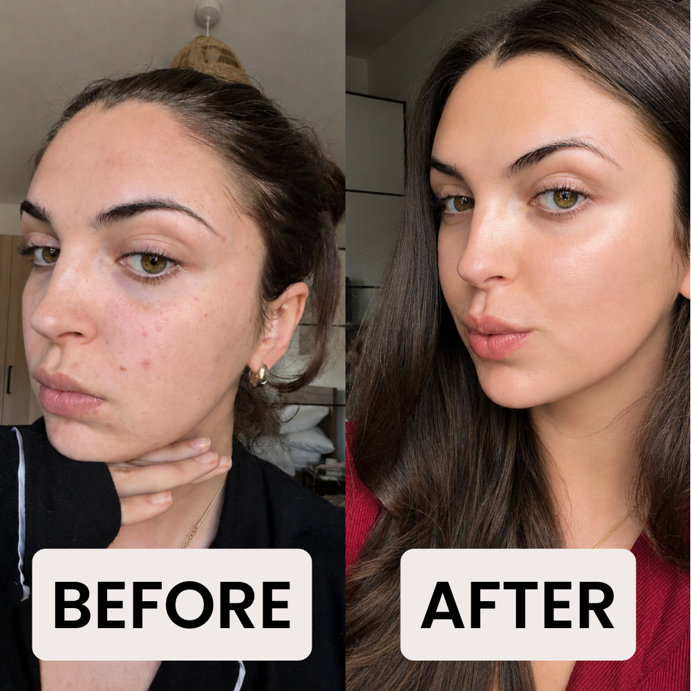 AHA Peeling Concentrate