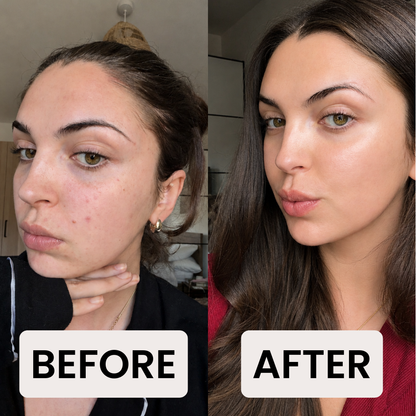 AHA Peeling Concentrate